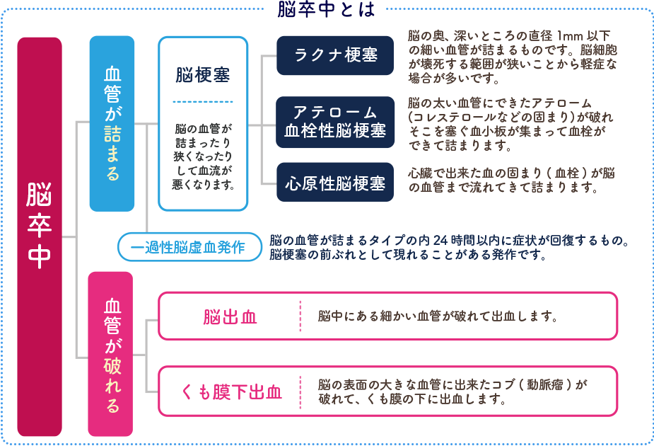 脳卒中とは