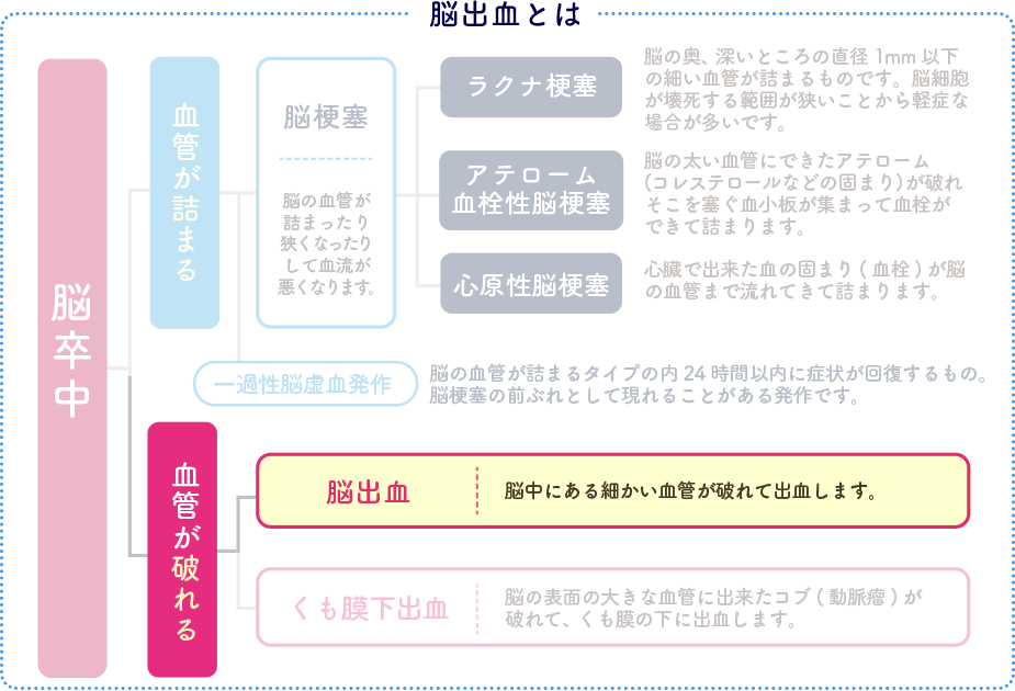 脳出血は脳卒中の一種で脳の血管が破れて出血する疾患