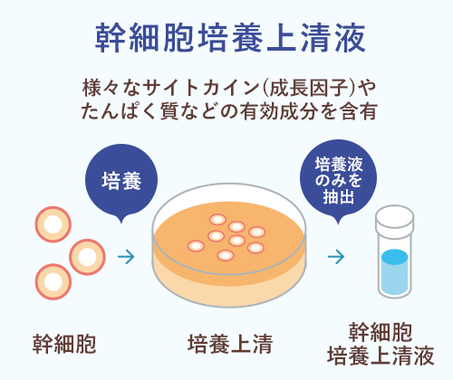 幹細胞培養上清液療法