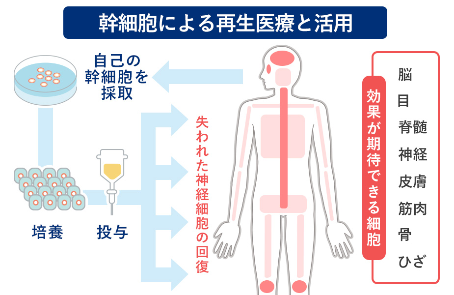 幹細胞による再生医療と活用