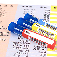 採血・感染症検査