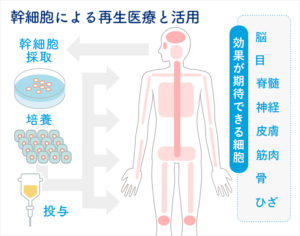 幹細胞による再生医療と活用