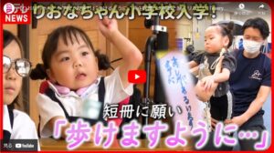 メディア情報「再生医療への挑戦と続くリハビリ」